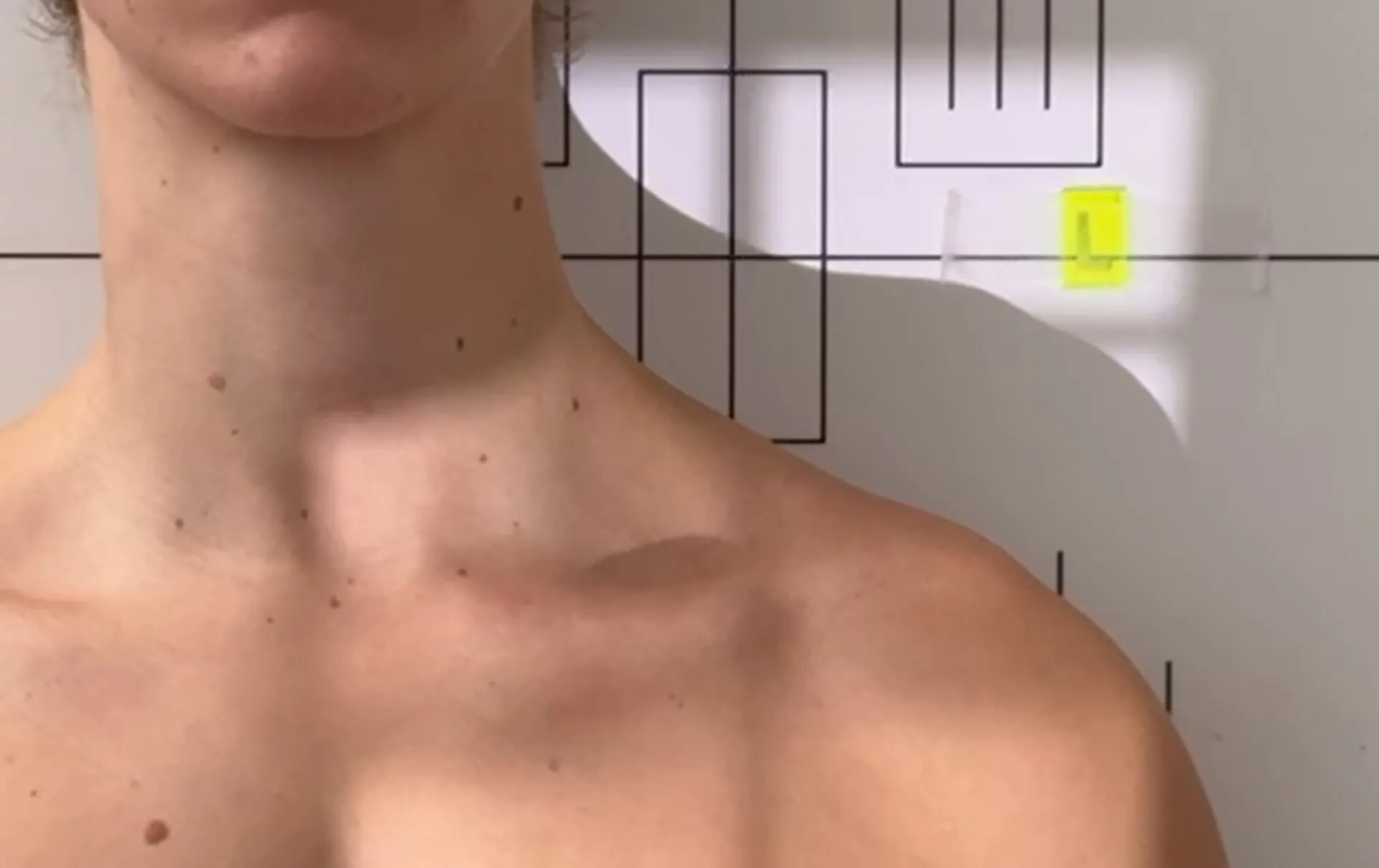 Clavicula tangential